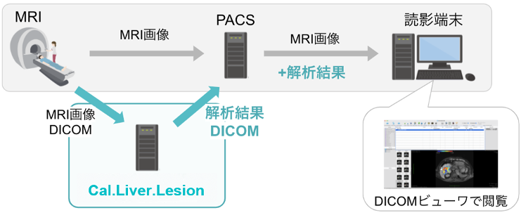 画像解析ソフトウェア Cal.Liver.Lesion