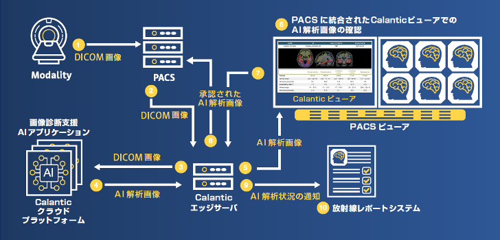 Calanticのワークフローの一例